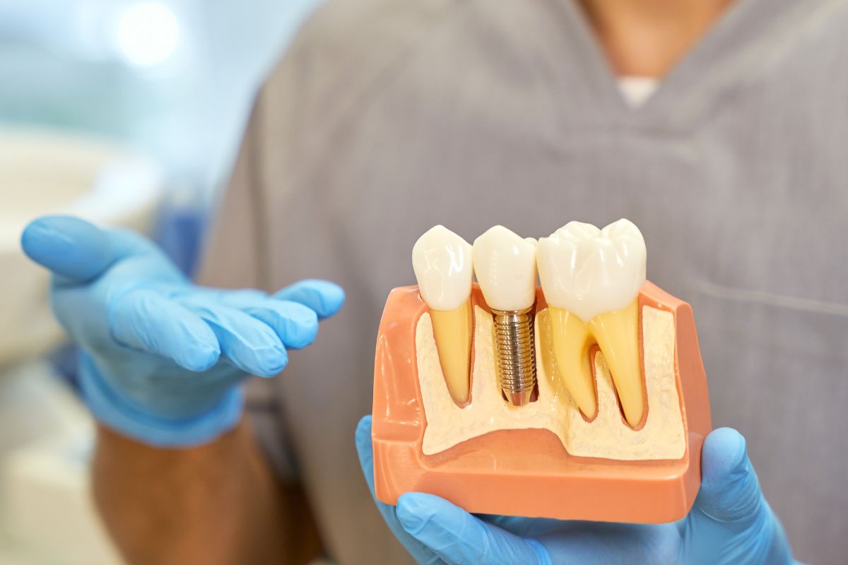 Are Dental Implants Safe? Everything You Need to Know