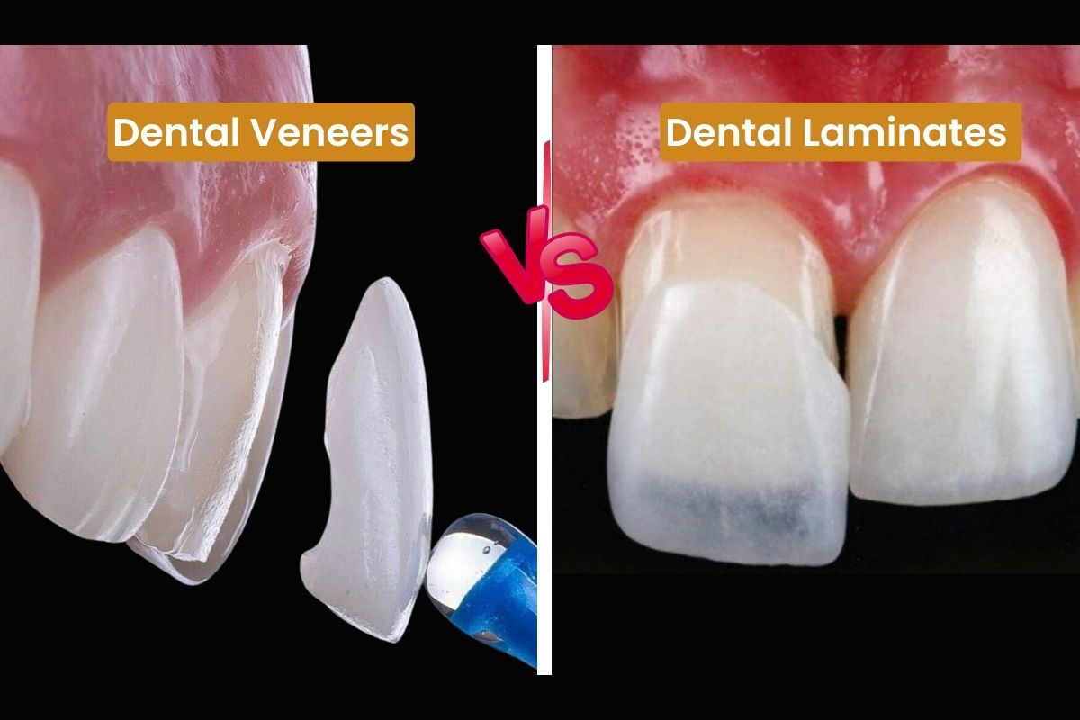 How Much Do Dental Crowns Cost