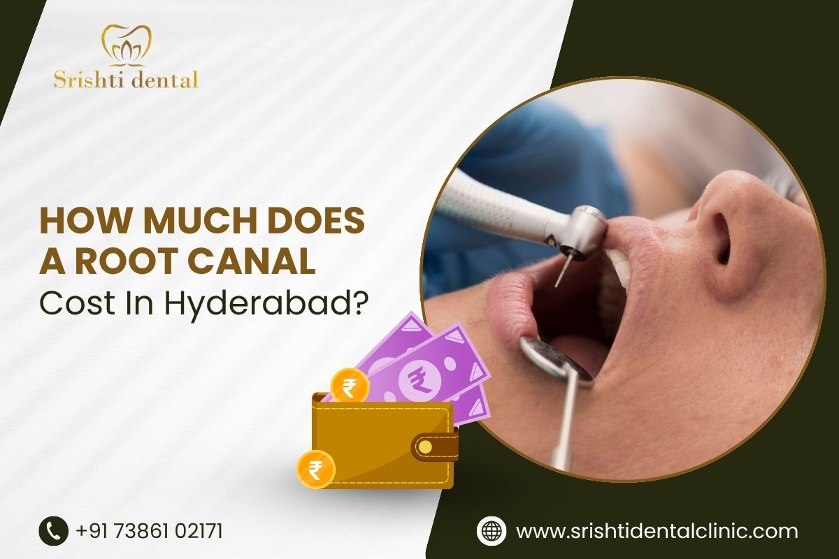 How Much Does A Root Canal Cost In Hyderabad?