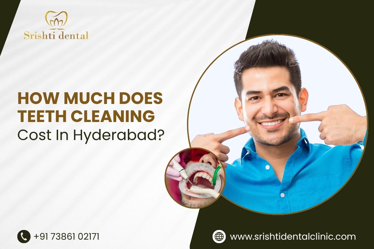 How much does teeth cleaning cost in Hyderabad?