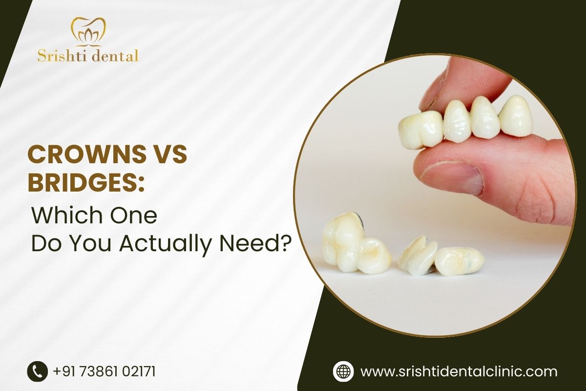 dental crowns and bridges treatment in Madhapur