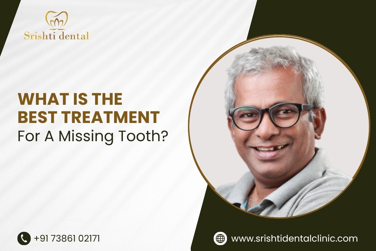missing tooth treatment in madhapur