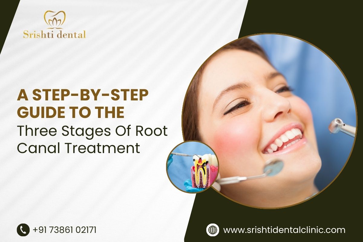 root canal treatment in madhapur